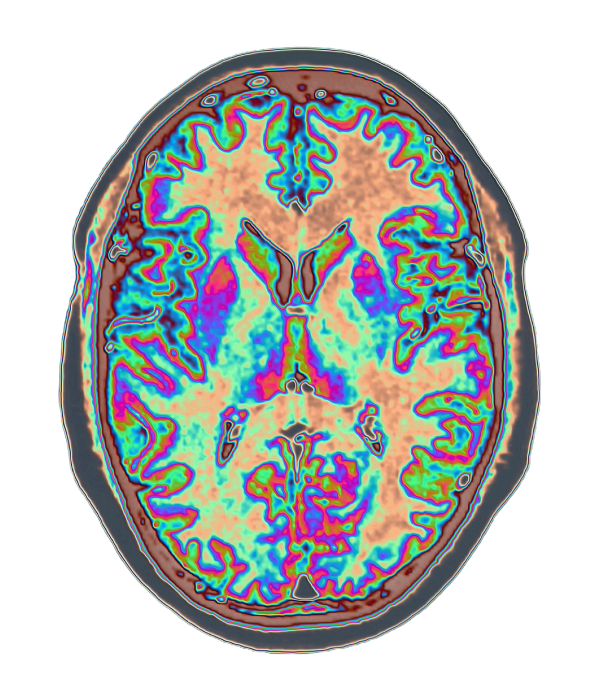 Brain Anatomy Perception UI