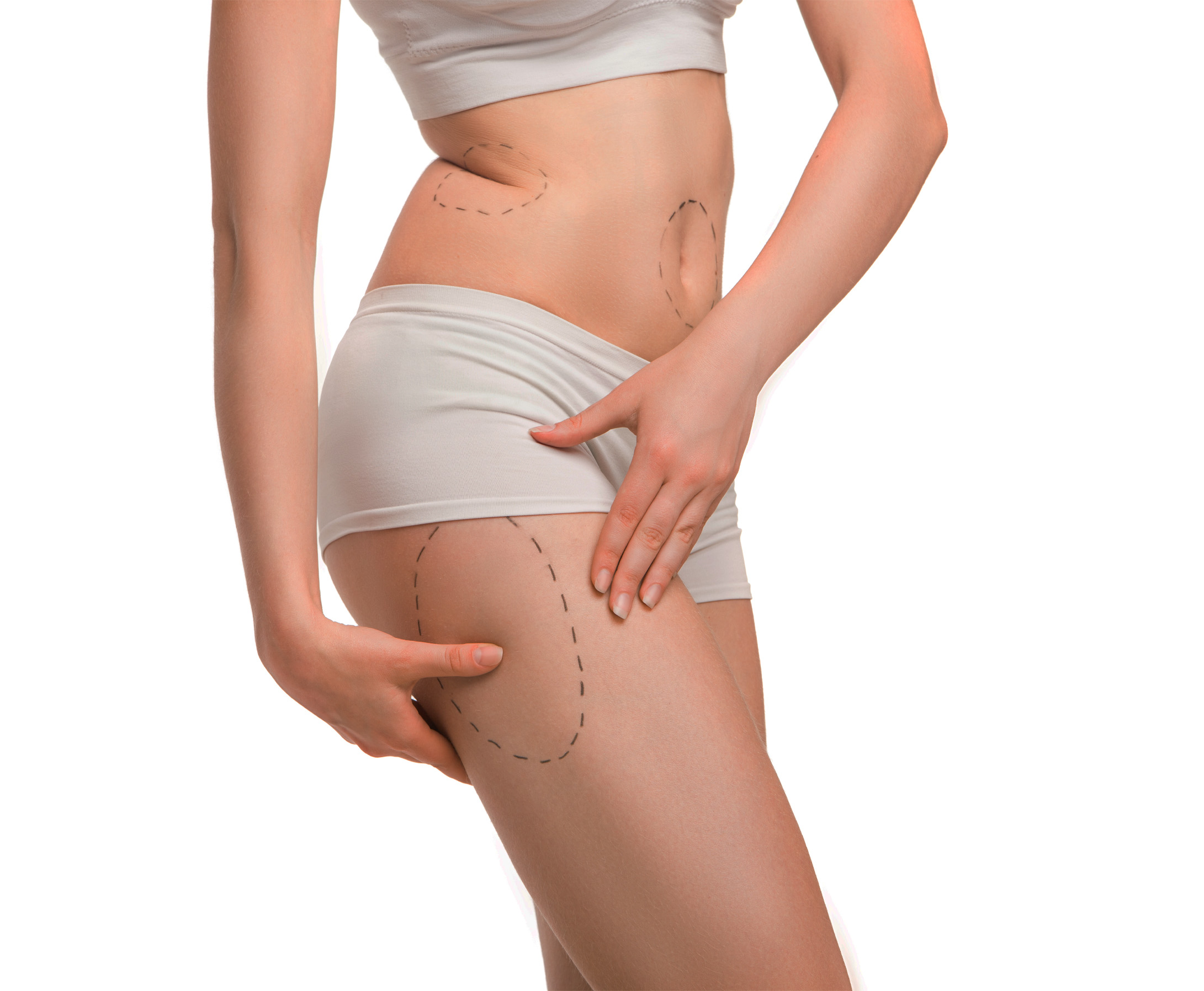 Thigh Tuck